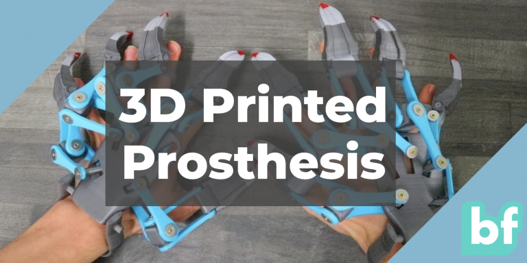 Top 15 Prosthetics Made With 3d Printing Bitfab